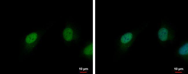 CDK6 antibody [N3C3] detects CDK6 protein at nucleus by immunofluorescent analysis.Sample: HeLa cells were fixed in 4% paraformaldehyde at RT for 15 min.Green: CDK6 protein stained by CDK6 antibody [N3C3] (NBP2-15846) diluted at 1:500.Blue: Hoechst 33342 staining. 