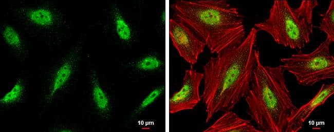 Immunocytochemistry/ Immunofluorescence Cdk9 Antibody