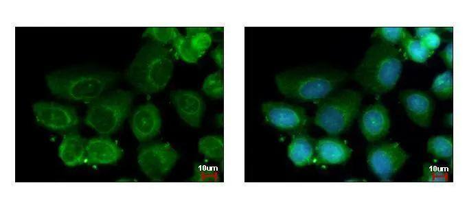 HAUS2 antibody [N1C3-2] detects HAUS2 protein at cytoplasm by immunofluorescent analysis. Sample: A431 cells were fixed in ice-cold MeOH for 5 min.Green: HAUS2 protein stained by HAUS2 antibody [N1C3-2] (NBP2-15861) diluted at 1:500.Blue: Hoechst 33343 staining. 
