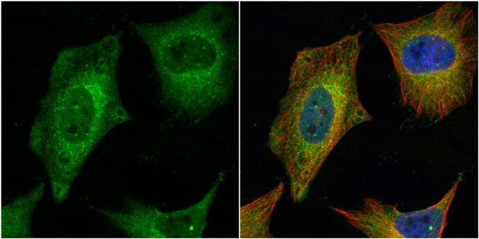 HAUS2 antibody [N1C3-2] detects HAUS2 protein at cytoplasm by immunofluorescent analysis.Sample: HeLa cells were fixed in 4% paraformaldehyde at RT for 15 min.Green: HAUS2 protein stained by HAUS2 antibody [N1C3-2] (NBP2-15861) diluted at 1:1000.Red: alpha Tubulin, a cytoskeleton marker, stained by alpha Tubulin antibody [GT114]  diluted at 1:1000.Blue: Hoechst 33342 staining. 