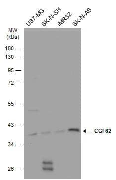 Various whole cell extracts (30 ug) were separated by 10% SDS-PAGE, and the membrane was blotted with CGI 62 antibody (NBP2-15870) diluted at 1:500. The HRP-conjugated anti-rabbit IgG antibody  was used to detect the primary antibody. 