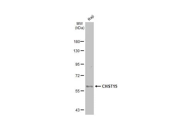Western Blot: Carbohydrate Sulfotransferase 15/CHST15 Antibody [NBP2-15896] - Whole cell extract (30 ug) was separated by 7.5% SDS-PAGE, and the membrane was blotted with Carbohydrate Sulfotransferase 15/CHST15 antibody [N3C2], Internal (NBP2-15896) diluted at 1:500. The HRP-conjugated anti-rabbit IgG antibody  was used to detect the primary antibody, and the signal was developed with Trident ECL plus-Enhanced.
