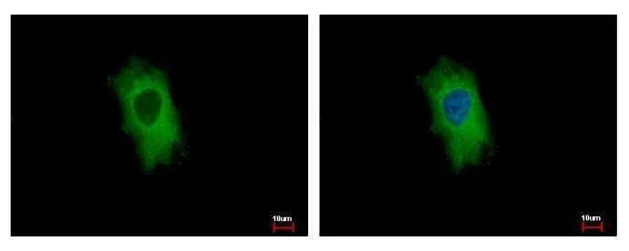 CIDEC antibody detects CIDEC protein at cytoplasm by immunofluorescent analysis. Sample: HeLa cells were fixed in 4% paraformaldehyde at RT for 15 min.Green: CIDEC protein stained by CIDEC antibody (NBP2-15903) diluted at 1:500.Blue: Hoechst 33343 staining. 