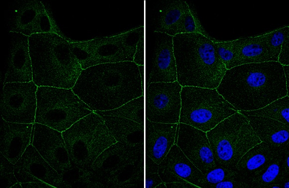 Immunocytochemistry/ Immunofluorescence: Cingulin Antibody [NBP2-15904] - Cingulin antibody detects Cingulin protein at cell membrane by immunofluorescent analysis.Sample: MDCK cells were fixed in 4% paraformaldehyde at RT for 15 min.Green: Cingulin stained by Cingulin antibody (NBP2-15904) diluted at 1:500.