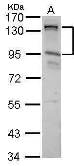 Western Blot: CIZ1 Antibody [NBP2-15906] - CIZ1 antibody [N2C1], Internal detects CIZ1 protein by Western blot analysis.A. 30 ug HeLa whole cell lysate/extract7.5 % SDS-PAGECIZ1 antibody [N2C1], Internal (NBP2-15906) dilution: 1:1000