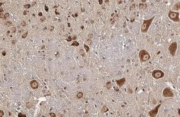 Immunohistochemistry-Paraffin: CKAP4/p63 Antibody [NBP2-15908] - CKAP4/p63 antibody [N3C3] detects CKAP4/p63 protein at cell membrane and cytoplasm by immunohistochemical analysis.Sample: Paraffin-embedded mouse brain.CKAP4/p63 stained by CKAP4/p63 antibody [N3C3] (NBP2-15908) diluted at 1:500.Antigen Retrieval: Citrate buffer, pH 6.0, 15 min