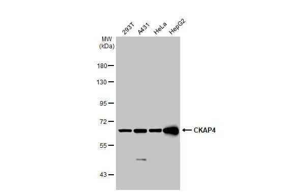 Western Blot: CKAP4/p63 Antibody [NBP2-15908] - Various whole cell extracts (30 ug) were separated by 7.5% SDS-PAGE, and the membrane was blotted with CKAP4/p63 antibody [N3C3] (NBP2-15908) diluted at 1:10000. The HRP-conjugated anti-rabbit IgG antibody  was used to detect the primary antibody.