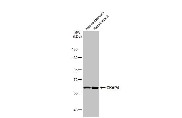 Western Blot: CKAP4/p63 Antibody [NBP2-15908] - Various tissue extracts (50 ug) were separated by 7.5% SDS-PAGE, and the membrane was blotted with CKAP4/p63 antibody [N3C3] (NBP2-15908) diluted at 1:1000. The HRP-conjugated anti-rabbit IgG antibody  was used to detect the primary antibody.