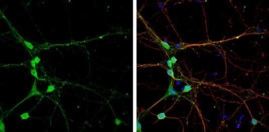 CLIP170 antibody [N1], N-term detects CLIP170 protein by immunofluorescent analysis.Sample: DIV9 rat E18 primary cortical neuron cells were fixed in 4% paraformaldehyde at RT for 15 min.Green: CLIP170 stained by CLIP170 antibody [N1], N-term (NBP2-15917) diluted at 1:500.Red: alpha Tubulin, stained by alpha Tubulin antibody [GT114]  diluted at 1:500.Blue: Fluoroshield with DAPI . 