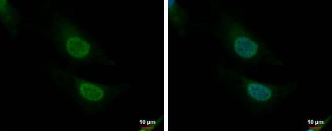 CNOT8 antibody detects CNOT8 protein at nucleus and cytoplasm by immunofluorescent analysis.Sample: HeLa cells were fixed in 4% paraformaldehyde at RT for 15 min.Green: CNOT8 protein stained by CNOT8 antibody (NBP2-15930) diluted at 1:200.Blue: Hoechst 33342 staining. 