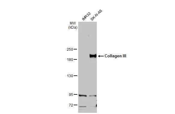 Western Blot Collagen III alpha 1/COL3A1 Antibody - BSA Free