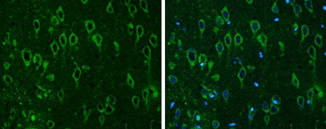 COMT antibody detects COMT protein at cytoplasm in rat brain by immunohistochemical analysis. Sample: Paraffin-embedded rat brain. COMT antibody (NBP2-15954) diluted at 1:500. br>Antigen Retrieval: Citrate buffer, pH 6.0, 15 min 