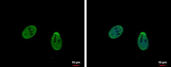 TRIP15 antibody detects TRIP15 protein at nucleus by immunofluorescent analysis.Sample: HeLa cells were fixed in 4% paraformaldehyde at RT for 15 min.Green: TRIP15 protein stained by TRIP15 antibody (NBP2-15958) diluted at 1:500.Blue: Hoechst 33342 staining. 