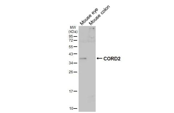 Various tissue extracts (50 ug) were separated by 12% SDS-PAGE, and the membrane was blotted with CORD2 antibody (NBP2-15964) diluted at 1:1000. The HRP-conjugated anti-rabbit IgG antibody  was used to detect the primary antibody. 