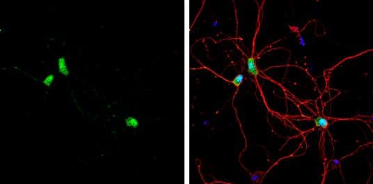 CPEB1 antibody [C3], C-term detects CPEB1 protein by immunofluorescent analysis.Sample: DIV9 rat E18 primary hippocampal neuron cells were fixed in 4% paraformaldehyde at RT for 15 min.Green: CPEB1 stained by CPEB1 antibody [C3], C-term (NBP2-15980) diluted at 1:500.Red: beta Tubulin 3/ Tuj1, stained by beta Tubulin 3/ Tuj1 antibody [GT11710]  diluted at 1:500.Blue: Fluoroshield with DAPI . 