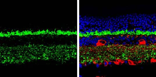 Complexin 3 antibody detects Complexin 3 protein by immunohistochemical analysis. Samples: Paraffin-embedded mouse retina.Green: Complexin 3 protein stained by Complexin 3 antibody (NBP2-15985) diluted at 1:250.Red: beta Tubulin 3/ Tuj1, a marker, stained by beta Tubulin 3/ Tuj1 antibody [GT1338]  diluted at 1:500.Blue: Fluoroshield with DAPI . br>Antigen Retrieval: Citrate buffer, pH 6.0, 15 min 