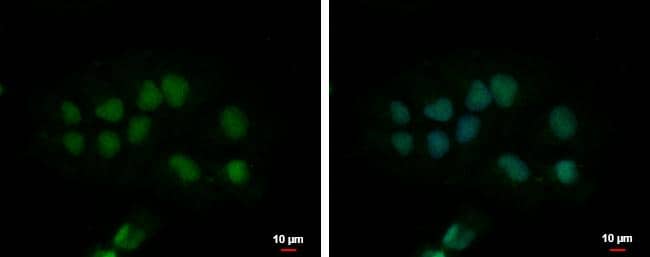 CPSF2 antibody [N1N3] detects CPSF2 protein at nucleus by immunofluorescent analysis.Sample: NT2D1 cells were fixed in 4% paraformaldehyde at RT for 15 min.Green: CPSF2 protein stained by CPSF2 antibody [N1N3] (NBP2-15989) diluted at 1:500.Blue: Hoechst 33342 staining.Scale bar = 10 um. 