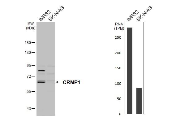 Various whole cell extracts (30 ug) were separated by 7.5% SDS-PAGE, and the membrane was blotted with CRMP1 antibody (NBP2-16015) diluted at 1:1000. The HRP-conjugated anti-rabbit IgG antibody  was used to detect the primary antibody. 