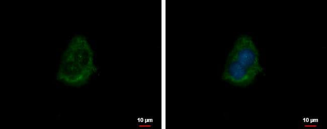 zeta Crystallin antibody [N1C1] detects zeta Crystallin protein at cytoplasm by immunofluorescent analysis.Sample: HepG2 cells were fixed in ice-cold MeOH for 5 min.Green: zeta Crystallin protein stained by zeta Crystallin antibody [N1C1] (NBP2-16017) diluted at 1:500.Blue: Hoechst 33342 staining.Scale bar = 10 um. 