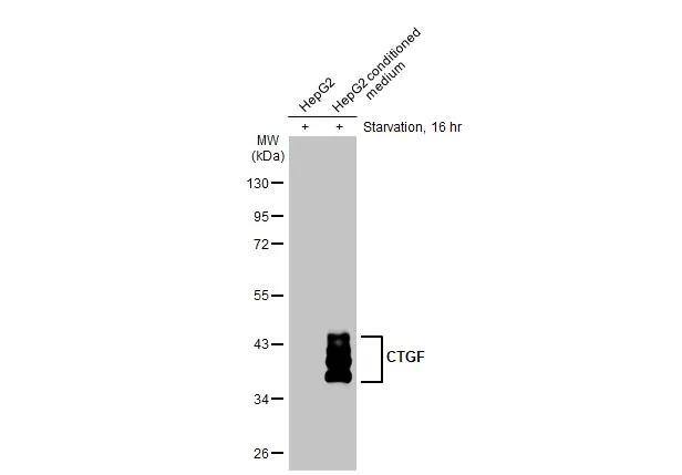 HepG2 whole cell extract and conditioned medium (30 ug) were separated by 10% SDS-PAGE, and the membrane was blotted with CTGF antibody (NBP2-16025) diluted at 1:1000. The HRP-conjugated anti-rabbit IgG antibody  was used to detect the primary antibody. 