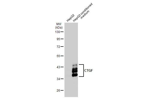 HepG2 conditioned medium (30 ug) were separated by 10% SDS-PAGE, and the membrane was blotted with CTGF antibody (NBP2-16026) diluted at 1:1000. The HRP-conjugated anti-rabbit IgG antibody  was used to detect the primary antibody. 