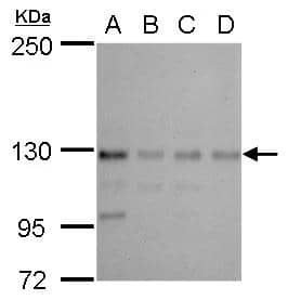 CTR9 antibody detects CTR9 protein by western blot analysis.A. 30 ug 293T whole cell lysate/extract B. 30 ug A431 whole cell lysate/extract C. 30 ug HeLa whole cell lysate/extractD. 30 ug HepG2 whole cell lysate/extract5 % SDS-PAGECTR9 antibody (NBP2-16031) dilution: 1:1000 