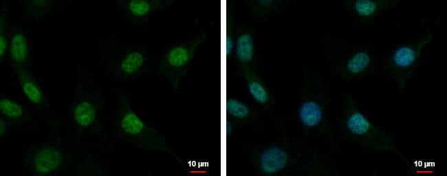 CUGBP2 antibody detects CUGBP2 protein at nucleus by immunofluorescent analysis.Sample: U87-MG cells were fixed in 4% paraformaldehyde at RT for 15 min.Green: CUGBP2 protein stained by CUGBP2 antibody (NBP2-16034) diluted at 1:500.Blue: Hoechst 33342 staining.Scale bar = 10 um. 