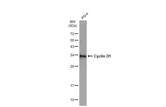 Western Blot: Cyclin D1 Antibody [NBP2-16054] - Whole cell extract (30 ug) was separated by 12% SDS-PAGE, and the membrane was blotted with Cyclin D1 antibody (NBP2-16054) diluted at 1:5000. The HRP-conjugated anti-rabbit IgG antibody  was used to detect the primary antibody, and the signal was developed with Trident ECL plus-Enhanced.