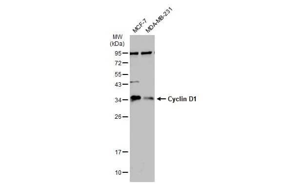 Western Blot: Cyclin D1 Antibody [NBP2-16054] - Various whole cell extracts (30 ug) were separated by 12% SDS-PAGE, and the membrane was blotted with Cyclin D1 antibody [N1C3] (NBP2-16054) diluted at 1:500. The HRP-conjugated anti-rabbit IgG antibody  was used to detect the primary antibody.