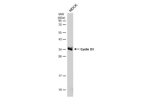 Western Blot: Cyclin D1 Antibody [NBP2-16054] - Whole cell extract (30 ug) was separated by 12% SDS-PAGE, and the membrane was blotted with Cyclin D1 antibody (NBP2-16054) diluted at 1:5000. The HRP-conjugated anti-rabbit IgG antibody  was used to detect the primary antibody, and the signal was developed with Trident ECL plus-Enhanced.