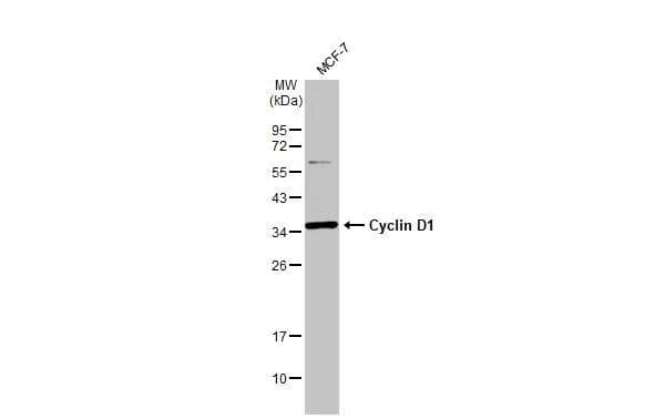 Whole cell extract (30 ug) was separated by 12% SDS-PAGE, and the membrane was blotted with Cyclin D1 antibody [N1C3] (NBP2-16054) diluted at 1:500. The HRP-conjugated anti-rabbit IgG antibody  was used to detect the primary antibody. 
