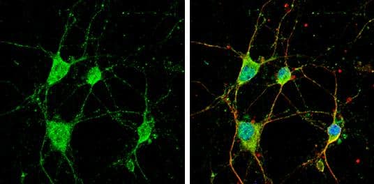 CYFIP1 antibody [N1N2], N-term detects CYFIP1 protein by immunofluorescent analysis.Sample: DIV9 rat E18 primary cortical neuron cells were fixed in 4% paraformaldehyde at RT for 15 min.Green: CYFIP1 stained by CYFIP1 antibody [N1N2], N-term (NBP2-16060) diluted at 1:500.Red: beta Tubulin 3/ Tuj1, stained by beta Tubulin 3/ Tuj1 antibody [GT1338]  diluted at 1:500.Blue: Fluoroshield with DAPI . 