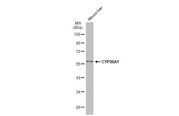 Western Blot: CYP26A1 Antibody [NBP2-16061] - Mouse tissue extract (50 ug) was separated by 10% SDS-PAGE, and the membrane was blotted with CYP26A1 antibody (NBP2-16061) diluted at 1:1000. The HRP-conjugated anti-rabbit IgG antibody  was used to detect the primary antibody.