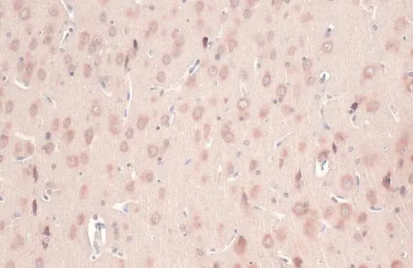 Immunohistochemistry-Paraffin: CYP26A1 Antibody [NBP2-16061] - CYP26A1 antibody detects CYP26A1 protein at cytoplasm by immunohistochemical analysis.Sample: Paraffin-embedded mouse brain.CYP26A1 stained by CYP26A1 antibody (NBP2-16061) diluted at 1:500.Antigen Retrieval: Citrate buffer, pH 6.0, 15 min