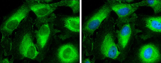 Immunocytochemistry/ Immunofluorescence CYP3A43 Antibody