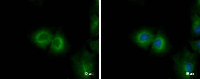 Immunocytochemistry/ Immunofluorescence Cytochrome P450 4F11 Antibody