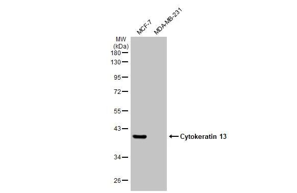 Western Blot: Cytokeratin 13 Antibody [NBP2-16086] - Various whole cell extracts (30 ug) were separated by 10% SDS-PAGE, and the membrane was blotted with Cytokeratin 13 antibody (NBP2-16086) diluted at 1:5000. The HRP-conjugated anti-rabbit IgG antibody  was used to detect the primary antibody.