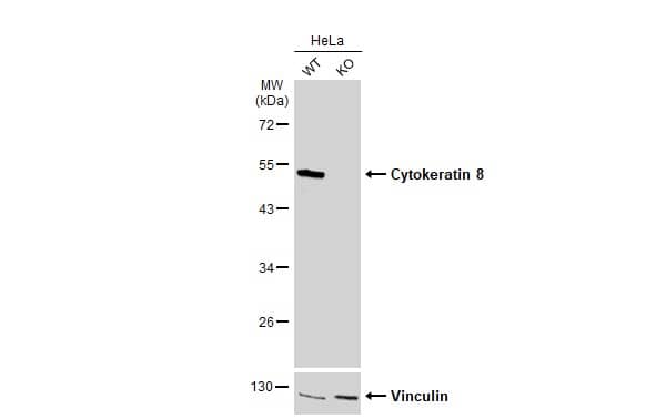 Western Blot: Cytokeratin 8 Antibody [NBP2-16094] - Wild-type (WT) and Cytokeratin 8 knockout (KO) HeLa cell extracts (30 ug) were separated by 10% SDS-PAGE, and the membrane was blotted with Cytokeratin 8 antibody  diluted at 1:20000. The HRP-conjugated anti-rabbit IgG antibody  was used to detect the primary antibody.