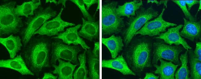 Cytokeratin 8 antibody detects Cytokeratin 8 protein at cytoskeleton by immunofluorescent analysis.Sample: HeLa cells were fixed in 4% paraformaldehyde at RT for 15 min.Green: Cytokeratin 8 stained by Cytokeratin 8 antibody (NBP2-16094) diluted at 1:500.Blue: Hoechst 33342 staining. 