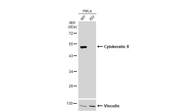 <b>Genetic Strategies Validation. </b>Wild-type (WT) and Cytokeratin 8 knockout (KO) HeLa cell extracts (30 ug) were separated by 10% SDS-PAGE, and the membrane was blotted with Cytokeratin 8 antibody (NBP2-16094) diluted at 1:20000. The HRP-conjugated anti-rabbit IgG antibody  was used to detect the primary antibody. 