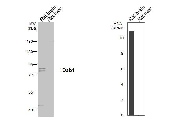 Various tissue extracts (50 ug) were separated by 7.5% SDS-PAGE, and the membrane was blotted with Dab1 antibody [N1N3] (NBP2-16095) diluted at 1:1000. The HRP-conjugated anti-rabbit IgG antibody  was used to detect the primary antibody. Corresponding RNA expression data are based on NCBI database. 