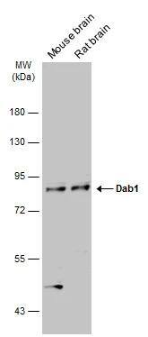 Various tissue extracts (50 ug) were separated by 7.5% SDS-PAGE, and the membrane was blotted with Dab1 antibody [N1N3] (NBP2-16095) diluted at 1:1000. The HRP-conjugated anti-rabbit IgG antibody  was used to detect the primary antibody. 