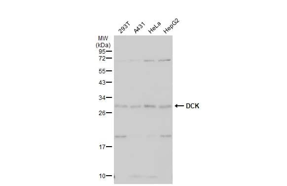 Western Blot: DCK Antibody [NBP2-16108] - Various whole cell extracts (30 ug) were separated by 12% SDS-PAGE, and the membrane was blotted with DCK antibody (NBP2-16108) diluted at 1:3000. The HRP-conjugated anti-rabbit IgG antibody  was used to detect the primary antibody.