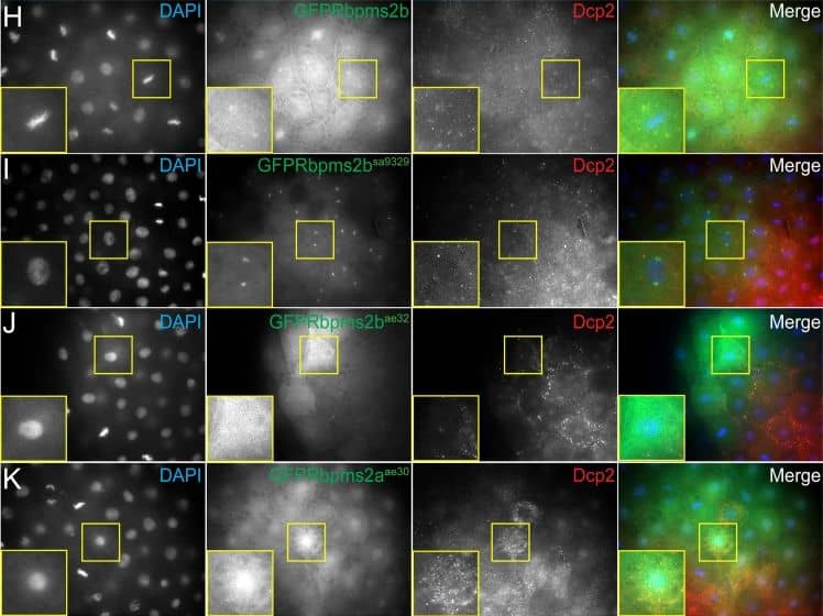 Immunocytochemistry/ Immunofluorescence: DCP2 Antibody [NBP2-16109] - rbpms2 mutant allele stability & localization activity in somatic cells.(A) RT-PCR to detect rbpms2a & rbpms2b maternal transcripts. Pink asterisks indicate likely nonsense mediated decay of mutant allele transcripts. (B-F) Wild-type GFP-Rbpms2a/b (B, D) & GFP-Rbpms2bsa9329 (F) localize to granules in HEK 293 cells, while GFP-Rbpms2aae30 & GFP-Rbpms2bae32 are not localized. (G-K) Zebrafish blastula cells expressing GFP-Rbpms2 fusions. (G,H) Wild-type GFP-Rbpms2b localizes near the nucleus (H), is apparently associated with the centrosome/spindle in some cells, & (G) is in granules that are not positive for the stress granule marker Tial-1. (H) A subset of GFP-Rbpms2b positive granules are positive for the p-body marker Dcp2 (open arrowheads). (I) GFP-Rbpms2bsa9329 localization to the centrosome/spindle but not granules. (J) GFP-Rbpms2bae32 & (K) GFP-Rbpms2aae30 localization. Insets show magnified views of the highlighted cells. Images are representative slices from Z-stacks of sphere stage embryos viewed from the animal pole. Image collected & cropped by CiteAb from the following publication (//pubmed.ncbi.nlm.nih.gov/29975683), licensed under a CC-BY license. Not internally tested by Novus Biologicals.