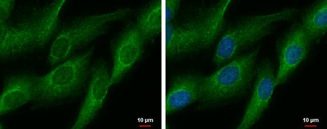 DDAH2 antibody [N2C3] detects DDAH2 protein at mitochondria by immunofluorescent analysis.Sample: SKNSH cells were fixed in 2% paraformaldehyde/culture medium at 37C for 15 min.Green: DDAH2 protein stained by DDAH2 antibody [N2C3] (NBP2-16121) diluted at 1:500.Blue: Hoechst 33342 staining.Scale bar = 10 um. 