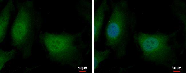DENR antibody detects DENR protein at cytoplasm and nucleus by immunofluorescent analysis.Sample: HeLa cells were fixed in 4% paraformaldehyde at RT for 15 min.Green: DENR protein stained by DENR antibody (NBP2-16148) diluted at 1:500.Blue: Hoechst 33342 staining. 