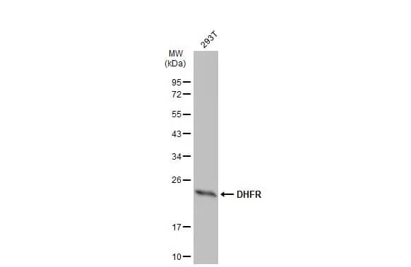 Western Blot: Dihydrofolate Reductase/DHFR Antibody [NBP2-16163] - Whole cell extract (30 ug) was separated by 12% SDS-PAGE, and the membrane was blotted with Dihydrofolate Reductase/DHFR antibody (NBP2-16163) diluted at 1:1000. The HRP-conjugated anti-rabbit IgG antibody  was used to detect the primary antibody, and the signal was developed with Trident ECL plus-Enhanced.