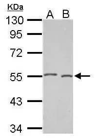 Western Blot: DNAJA2 Antibody [NBP2-16190] - Sample (30 ug of whole cell lysate)  A: whole zebrafish   B: zebrafish brain  10% SDS PAGE  NBP2-16190 diluted at 1:1000 