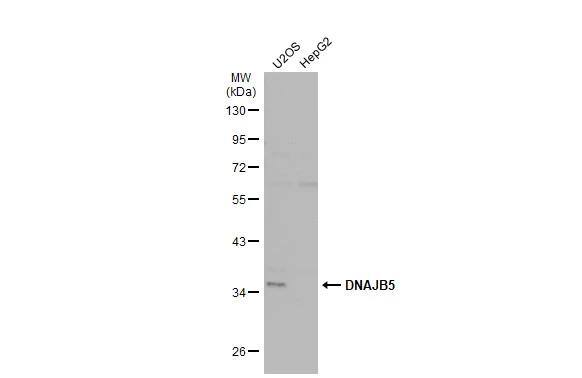 Various whole cell extracts (30 ug) were separated by 10% SDS-PAGE, and the membrane was blotted with DNAJB5 antibody (NBP2-16192) diluted at 1:500. The HRP-conjugated anti-rabbit IgG antibody  was used to detect the primary antibody. 
