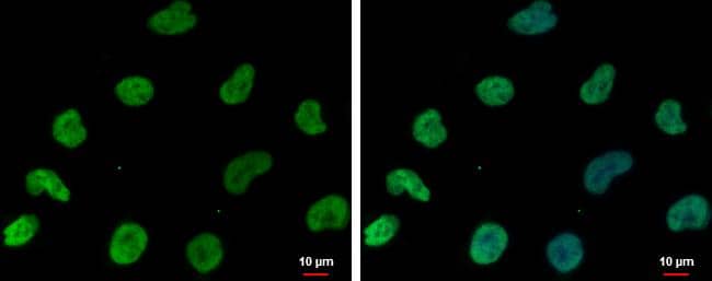 DNAJB6 antibody [N3C3] detects DNAJB6 protein at nucleus by immunofluorescent analysis.Sample: NT2D1 cells were fixed in 4% paraformaldehyde at RT for 15 min.Green: DNAJB6 protein stained by DNAJB6 antibody [N3C3] (NBP2-16193) diluted at 1:500.Blue: Hoechst 33342 staining.Scale bar = 10 um. 
